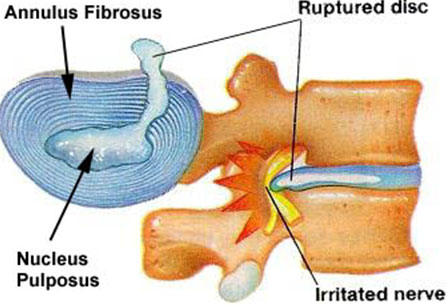 diskokili-2-mouratis