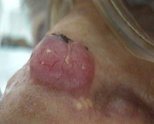 bcc2