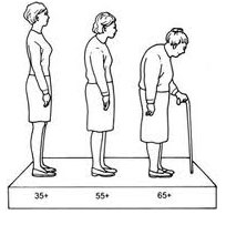 osteoporosi-odontiatriki