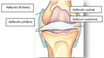 r.arthritida-1