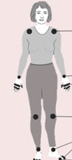 r.arthritida-6