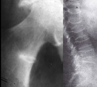 rahitida-2