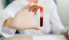 Χαμηλά αιμοπετάλια: Τι πρέπει να ξέρετε