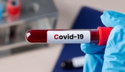 Έγκαιρη χορήγηση πλάσματος με υψηλούς τίτλους αντισωμάτων για την πρόληψη σοβαρής νόσου COVID-19 σε ηλικιωμένους